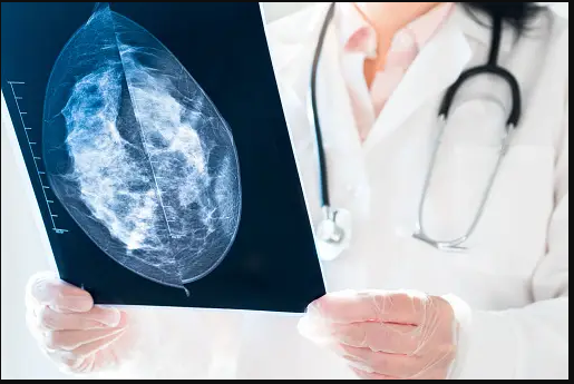 A eficácia das mamografias na detecção do câncer de mama em estágio inicial